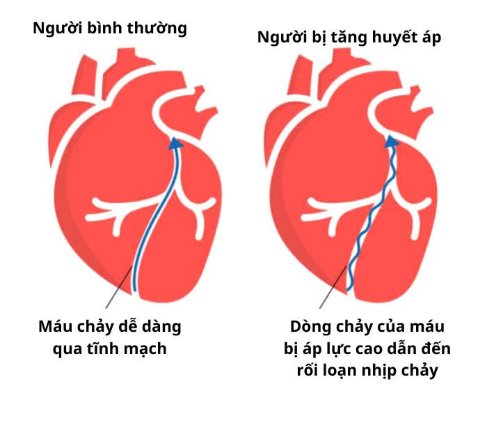  Ảnh minh họa/ Nguồn internet