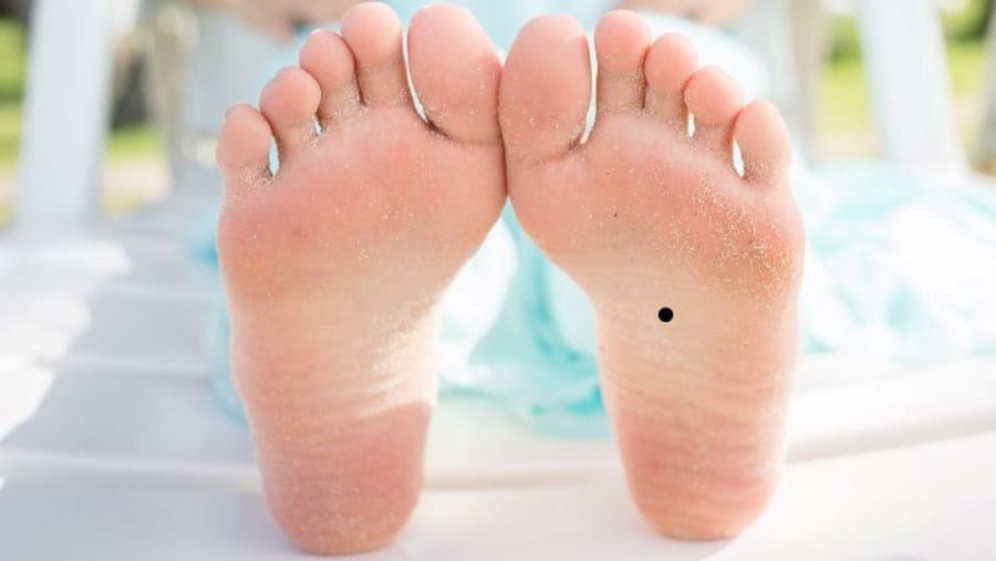  Người có nốt ruồi càng đen và to dưới lòng bàn chân càng mang lại điều cát lành cho chủ nhân, nhất là về tiền bạc. (Ảnh minh họa)
