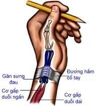  Biểu hiện của bệnh - Ảnh BSCC