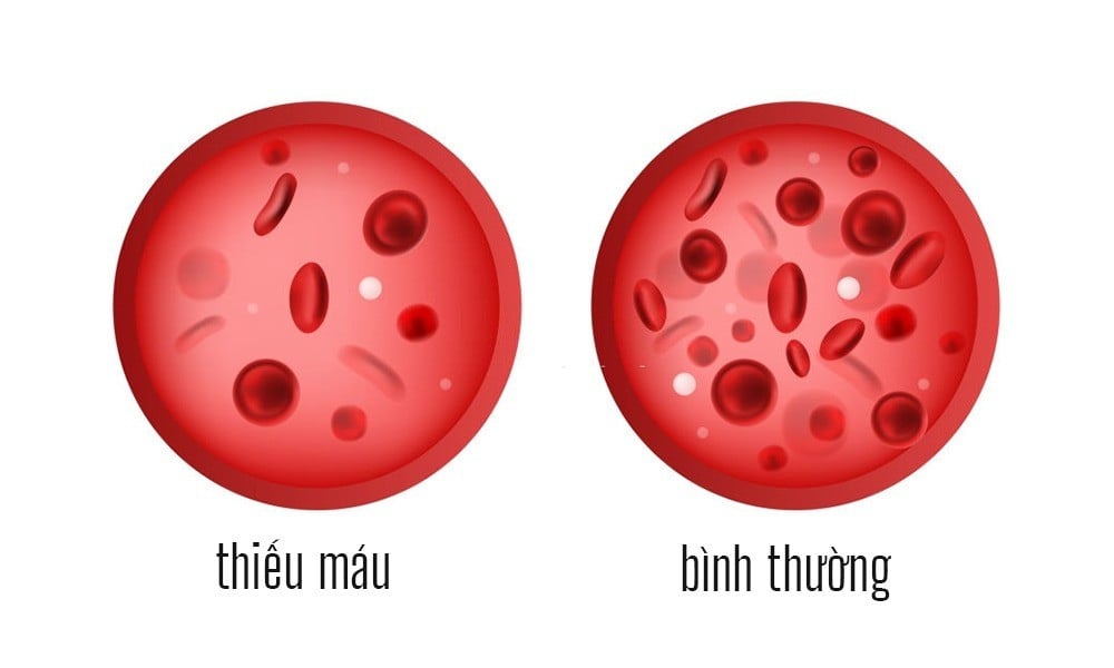  Ảnh minh họa/Nguồn Internet