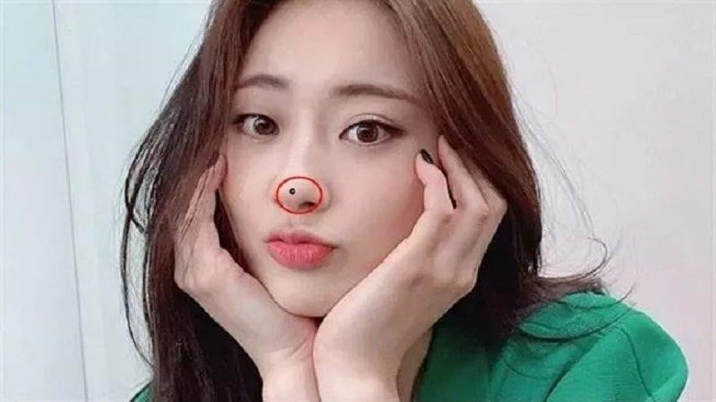  Nốt ruồi chặn tài lộc