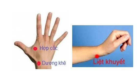  Các huyệt có tác dụng trị bệnh - Ảnh BVCC