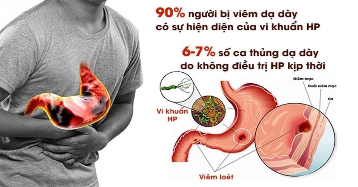  Ảnh minh họa/ Nguồn internet