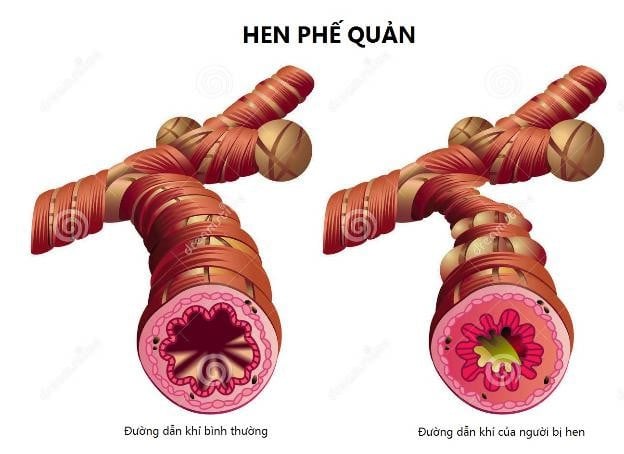  Ảnh minh họa/Nguồn Internet
