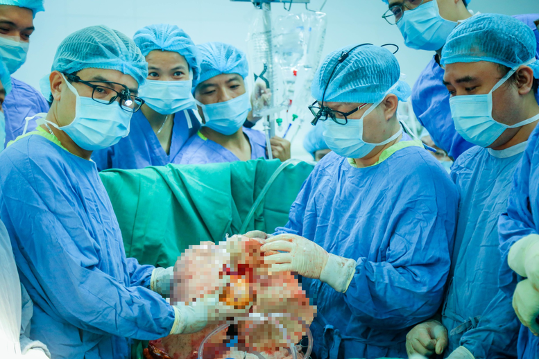  Ca phẫu thuật thành công kéo dài 7 giờ đồng hồ - Ảnh: VGP
