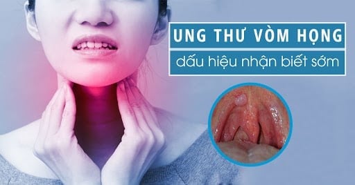 Khi khối u phát triển lớn hơn, nó có thể chèn ép dây thần kinh, gây ra tình trạng mất cảm giác hoặc tê yếu ở một bên mặt.
