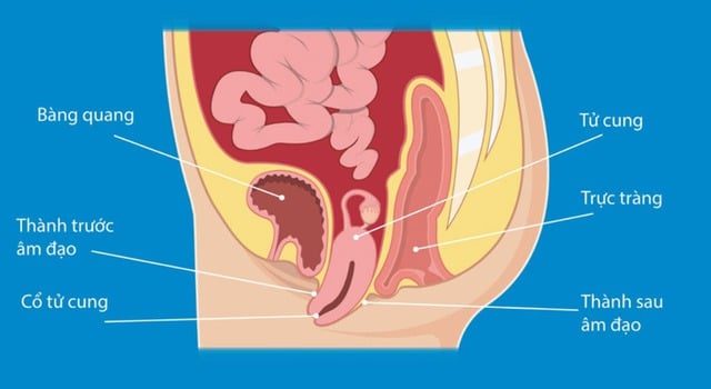 Sa cơ quan vùng chậu ảnh hưởng lớn đến sinh hoạt và đời sống tình dục, cần được phát hiện và điều trị sớm.