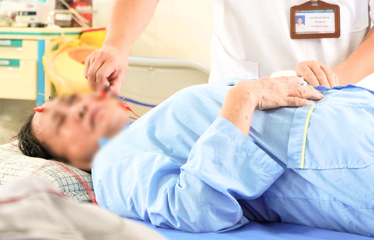 Châm cứu trị liệt mặt ngoại biên - Ảnh BVCC