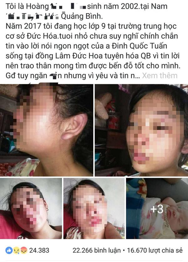Chị T lên facebook nói rằng mình bị chồng bạo hành.
