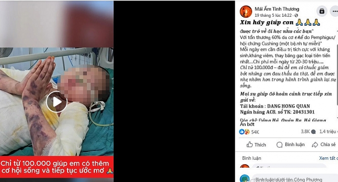 Hình ảnh cháu Hiền được chạy quảng cáo kêu gọi từ thiện vào số tài khoản lạ. Ảnh chụp màn hình.